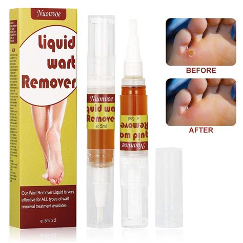 wart remover plantar wart remover wart removal corn remover wart removal   natural