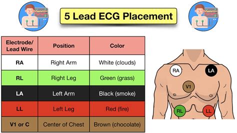 place   lead ecg acronym mnemonic diagram  electrode placement explained ezmed
