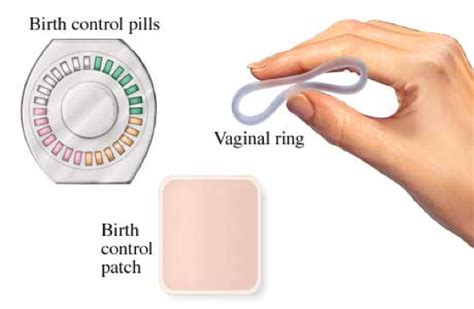 hormonal contraceptive methods sexinfo online
