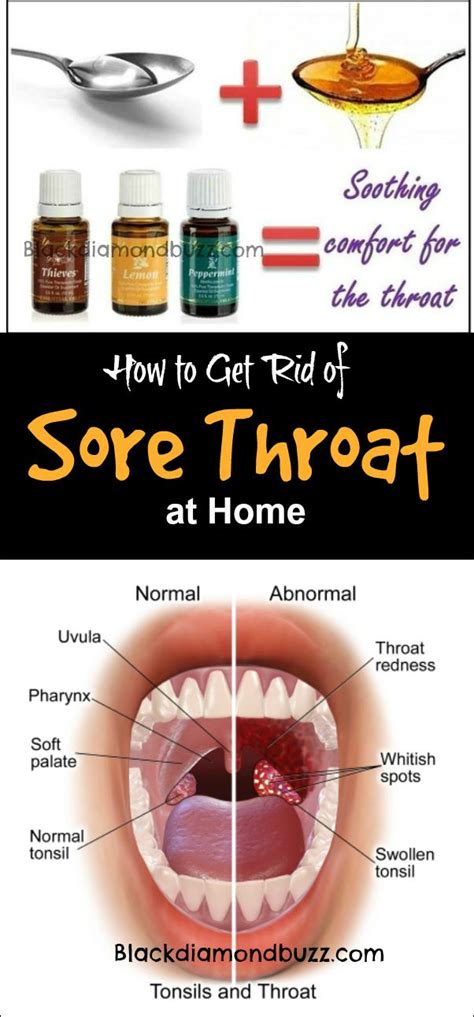 rid  sore throat