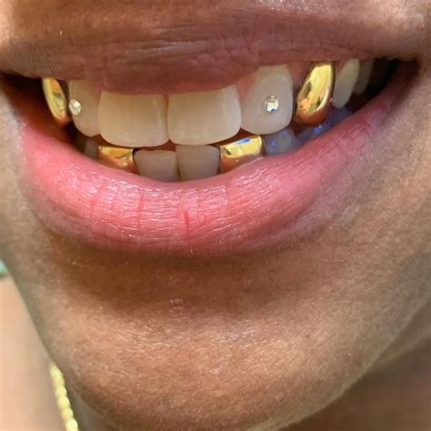 gold teeth master  instagram  check  atdocdiamond