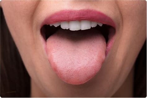 Microbes On The Tongue Could Be Used To Diagnose Pancreatic Cancer