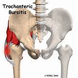 Photos of Right Hip Joint Pain