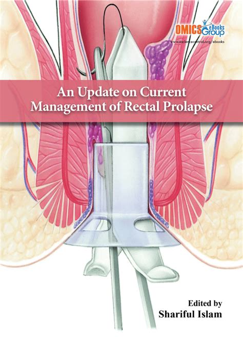 Pdf An Update On Current Management Of Rectal Prolapse
