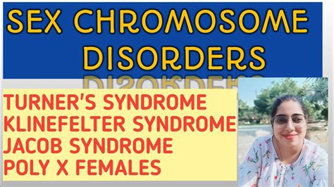 Sex Chromosomes Disorders Turners Syndrome Klinefelter Syndrome