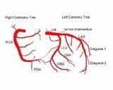 Pictures of Coronary Artery Diagram Of The Heart