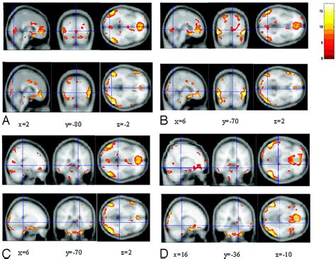 patterns of brain activation during visually evoked sexual