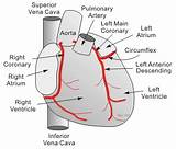 Coronary Artery Diagram