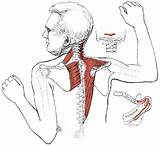 Images of Muscle Knots In Back Treatment