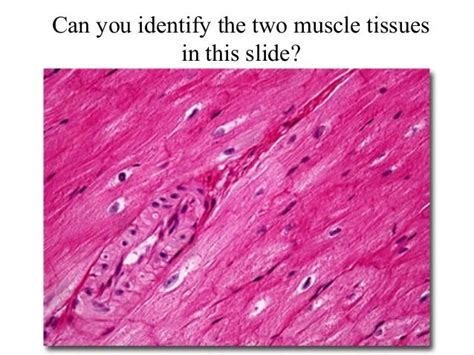 smooth muscle tissue