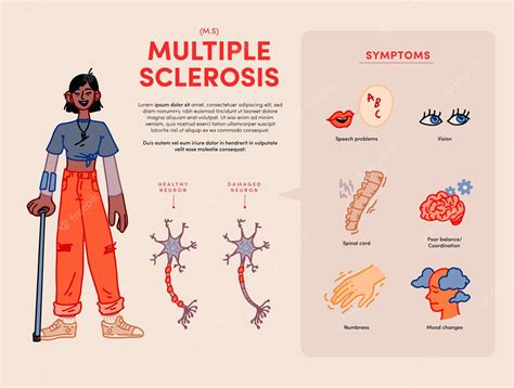 multiple sclerosis treatment  ayurveda subhash goyal blog