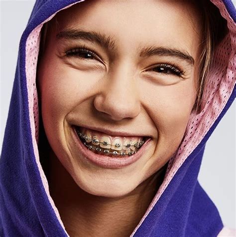 Pin By Sara Green On Brace Face Braces Girls Cute Girls With Braces