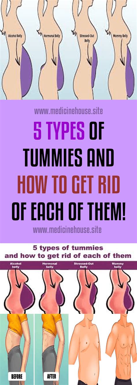 5 types of tummies and how to get rid of each of them tummy