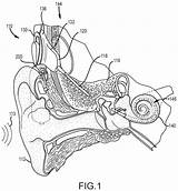 Patent Implant Cochlear Uspto sketch template