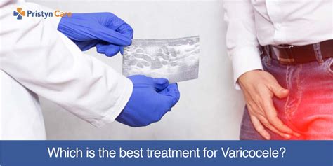 which is the best treatment for varicocele pristyn care