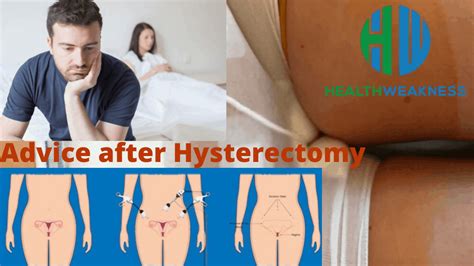 Experts Advice For Husbands After Hysterectomy Healthweakness