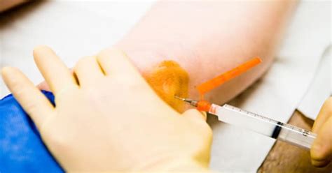 injections for knee arthritis types benefits risks