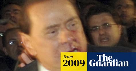Silvio Berlusconi Punched In The Face In Milan Silvio Berlusconi