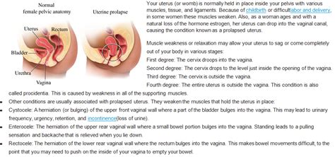Prolapsed Uterus Overview Prolapsed Uterus Uterus Uterine Prolapse