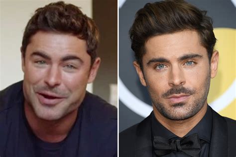 zac efron hits back at plastic surgery claims and reveals the real