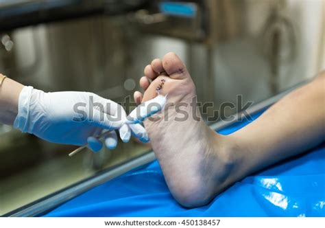 clean wound stock photo edit