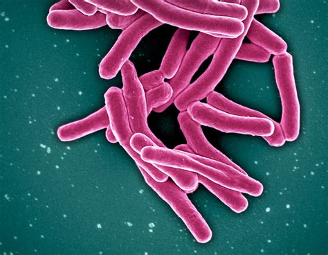mycobacterium tuberculosis bacteria    tb flickr