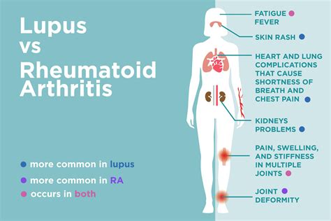 Chest Inflammation Allergies Bronchitis Contagious