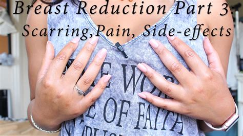breast reduction part   months  scarring pain side effects