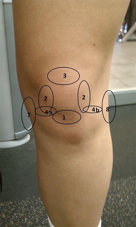 Dr David Kwon S Blog Ouch My Knee Hurts [part 1]