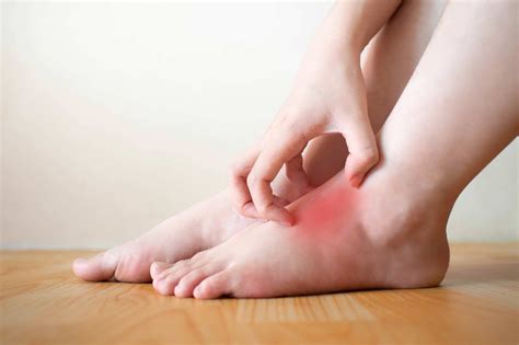 diabetic foot rash symptoms  treatment fresno  visalia podiatry