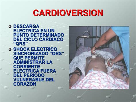 Ppt Cardioversion Y Desfibrilacion Powerpoint Presentation Free