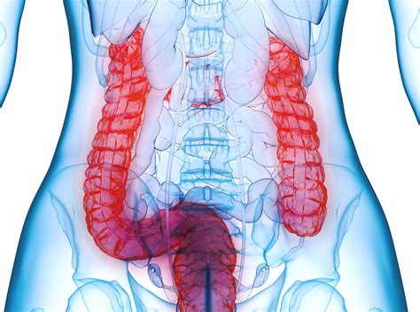increased intestinal permeability     crohn disease