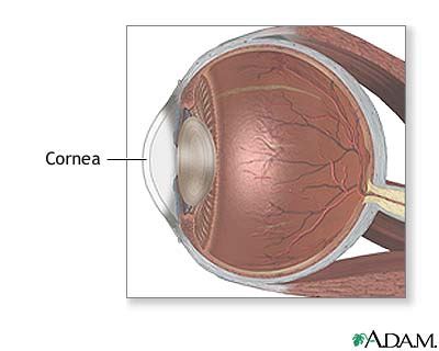 cornea medlineplus medical encyclopedia image