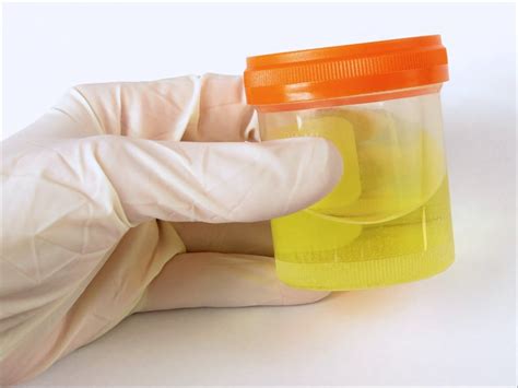 urine testing of prescribed psychotropics in addicts warranted