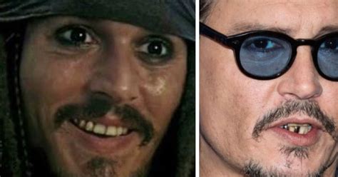 Johnny Depp S Teeth Are Not Healthy At All Celebrity