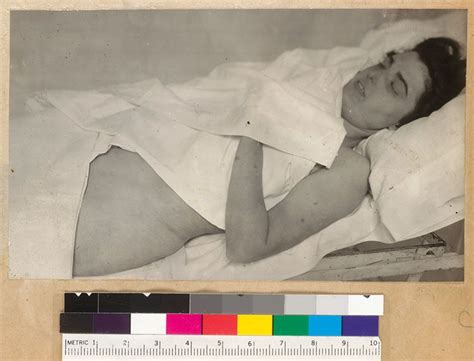 morgue photograph  virginia rappe morgue horror  photographer