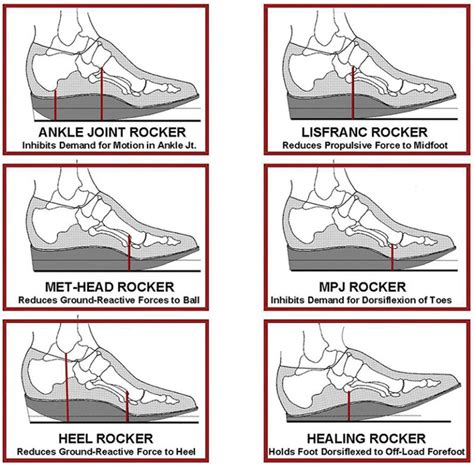 rocker bottom footwear effects  balance gait  extremity review magazine