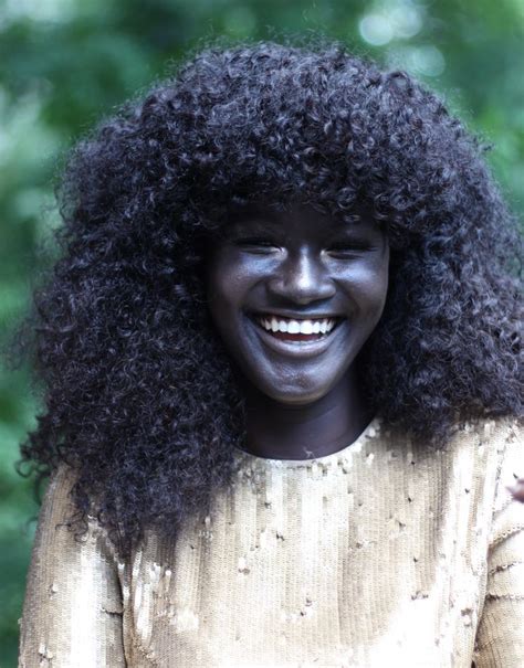 this girl was bullied for her skin color now she s a badass model
