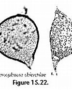 Afbeeldingsresultaten voor "solenosphaera Zanguebarica". Grootte: 149 x 136. Bron: palaeo-electronica.org