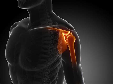 shoulder dislocations aica orthopedics
