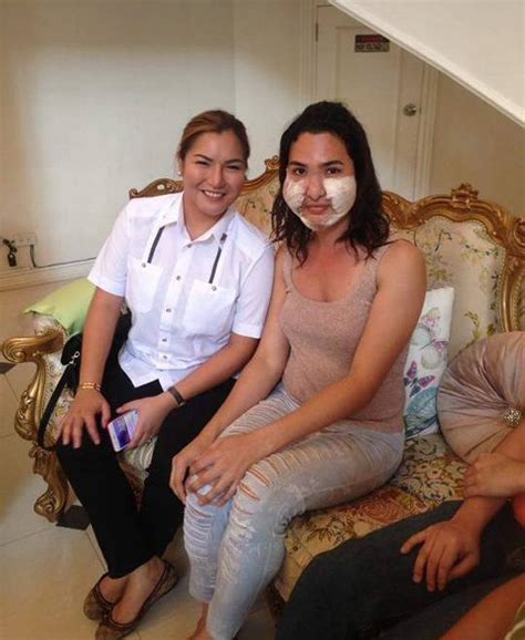 best friends left permanently disfigured following botched cosmetic surgery metro news