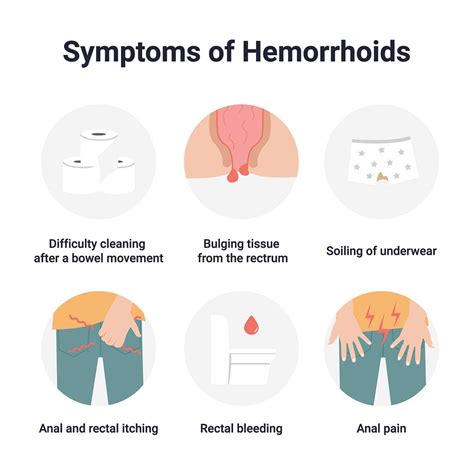 Hemorrhoids Northern Virginia Gastroenterology