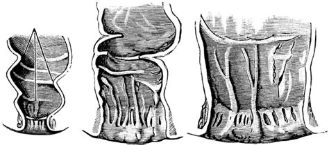 development of the anal cavity clipart etc