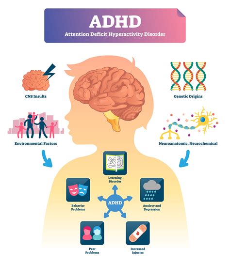 adhd vector illustration labeled attention deficit hyperactivity