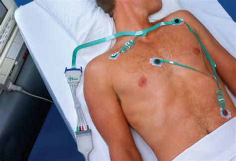 telemetry monitoring principles  monitoring  heart activity medical equipment