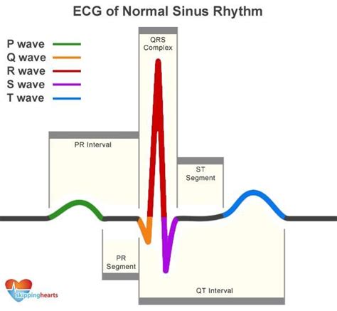 ecg  normal sinus rhythm rescue pinterest