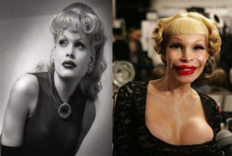 Two Faced Drastic Before And After Celebrity Plastic Surgery Bad