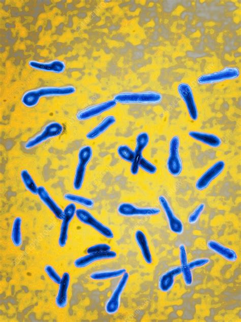Tetanus Bacteria Lm Stock Image C028 2803 Science Photo Library