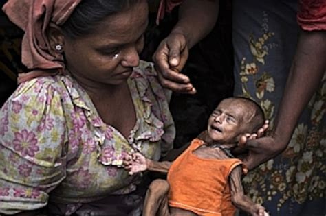 Health Crisis Worsens Among Muslim Rohingya People In Burma The