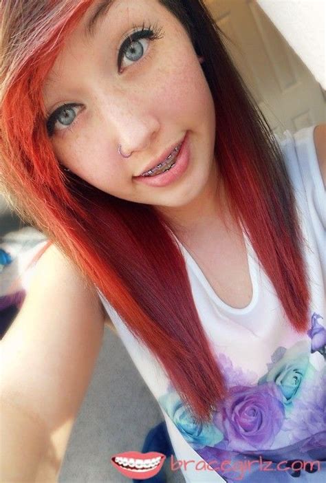 sweet blue eys tooth braces girl with freckles and nose piercing people with braces